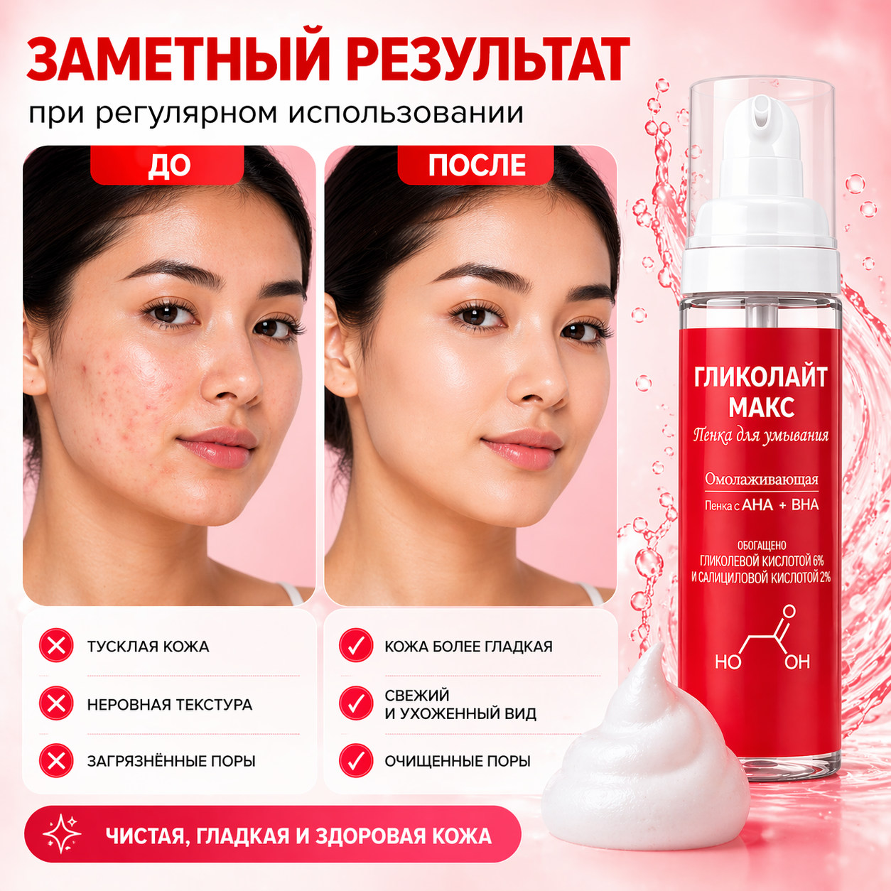 Гликолайт Макс пенка, 200 мл