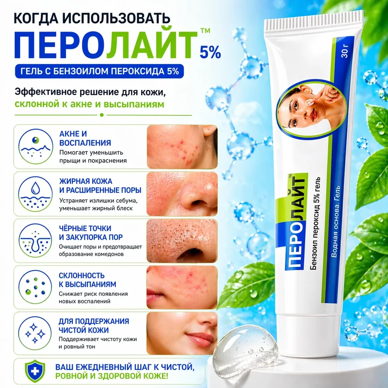 Перолайт 5% гель, 30 г