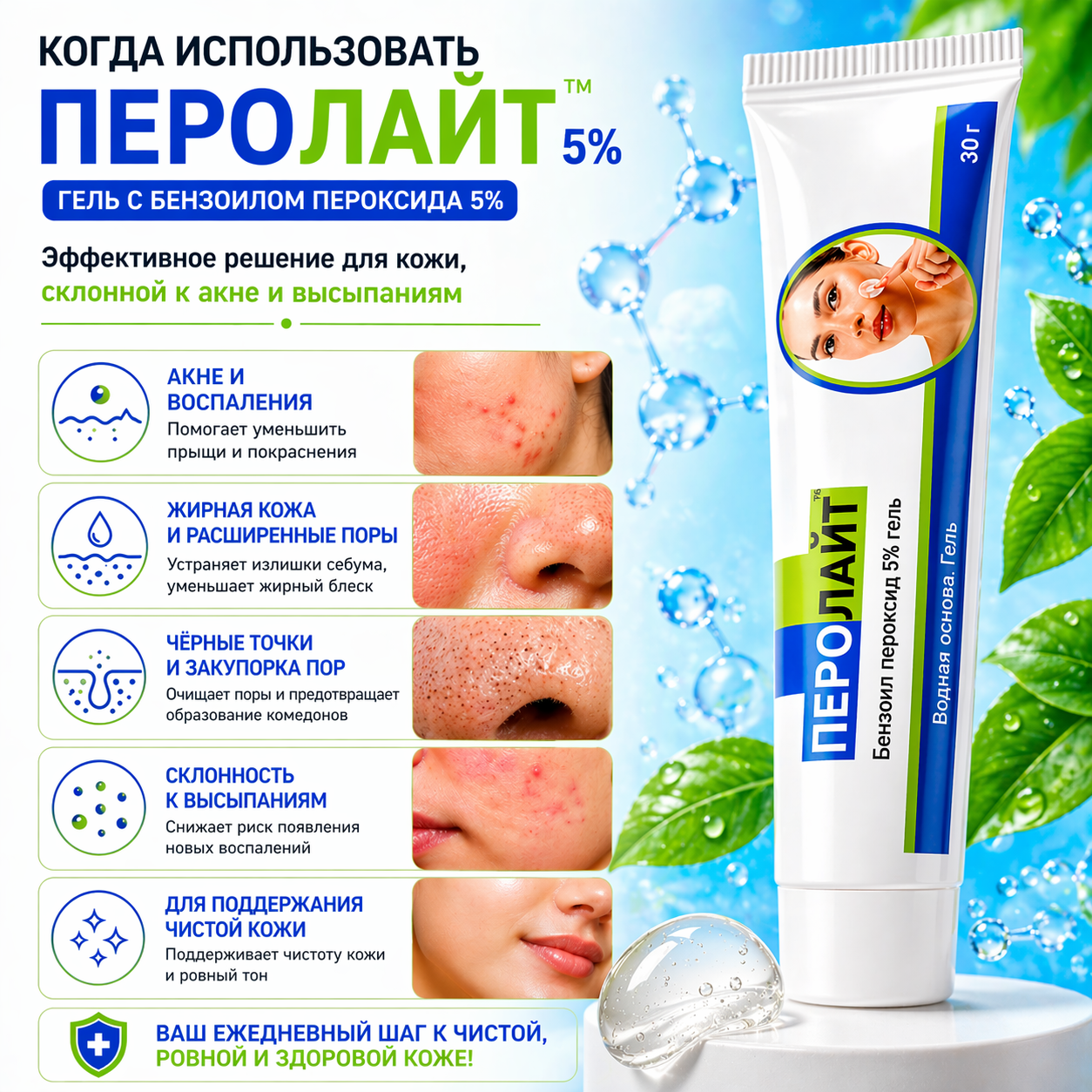 Перолайт 5% гель, 30 г