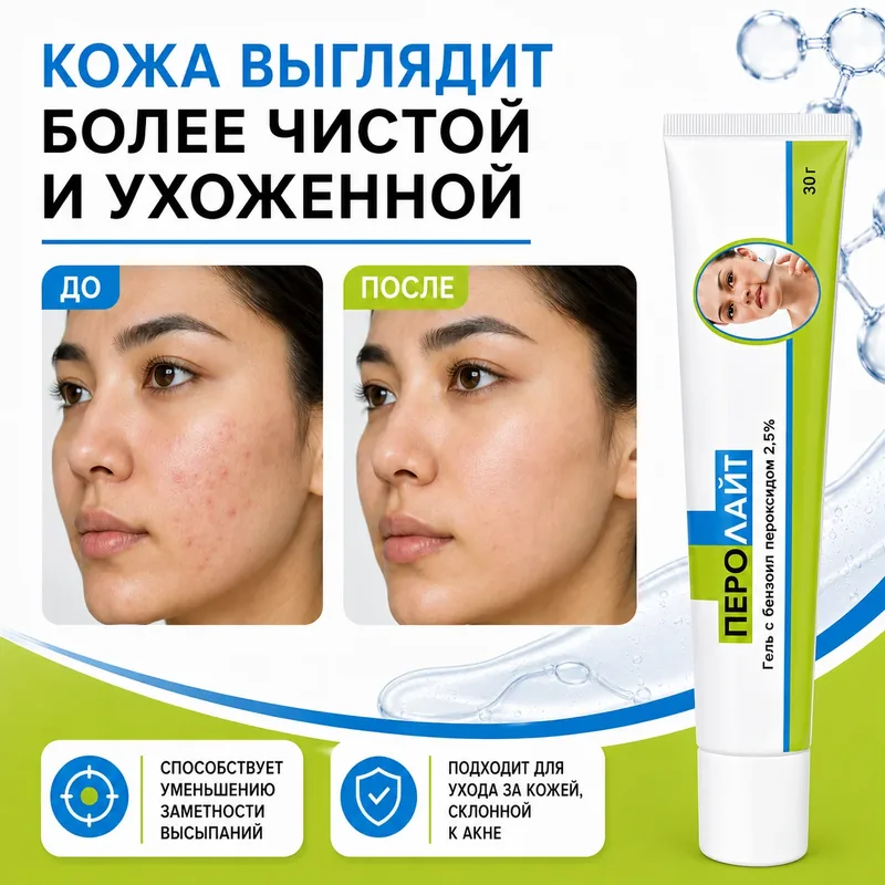 Перолайт 2,5% гель, 30 г