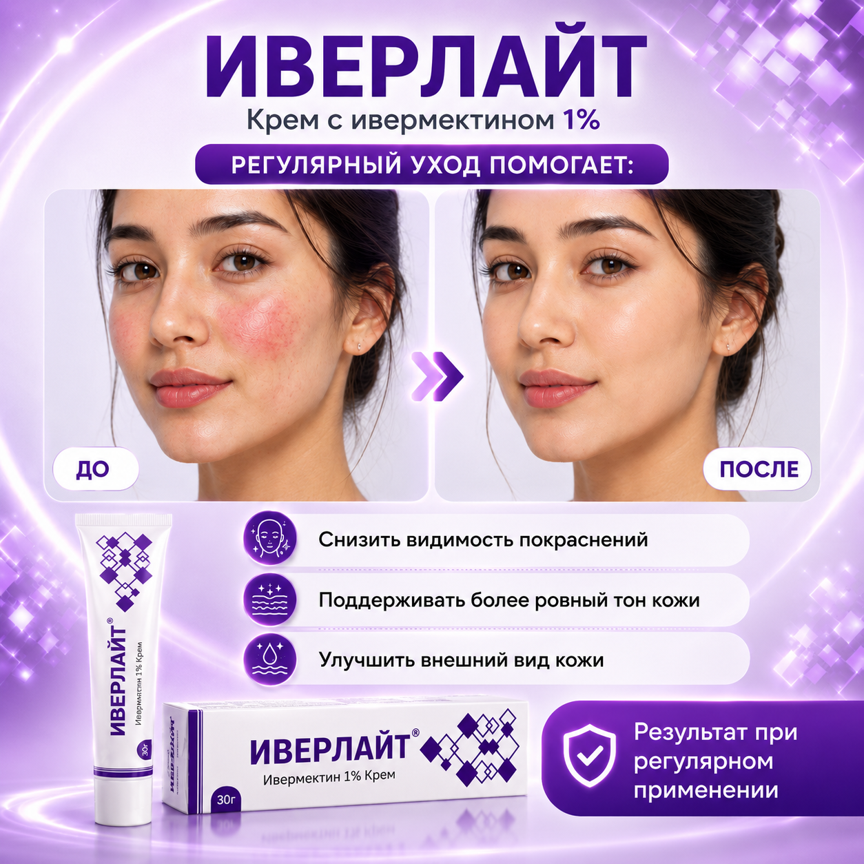 Иверлайт крем, 30 г