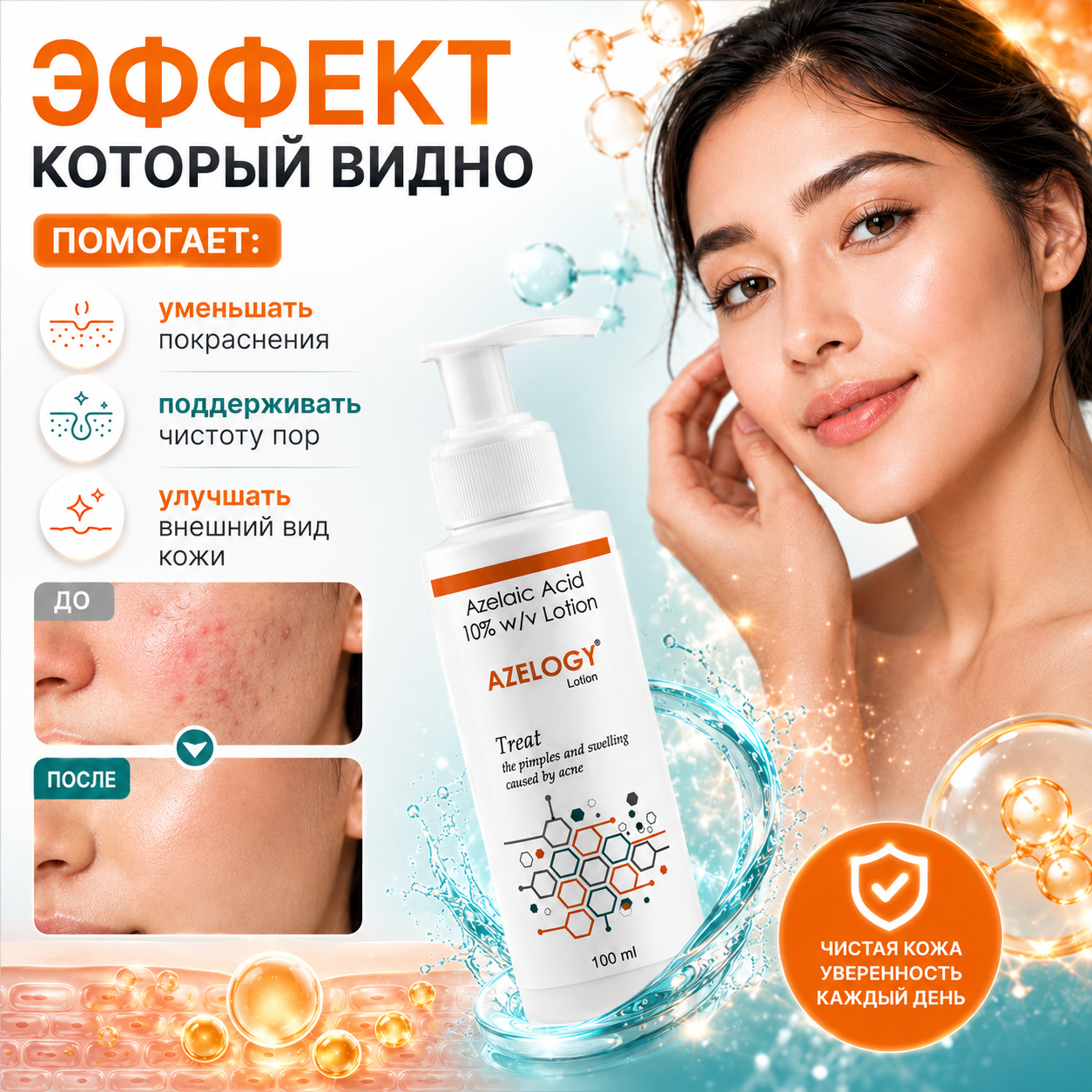 Азелоджи лосьон 10%, 100 мл